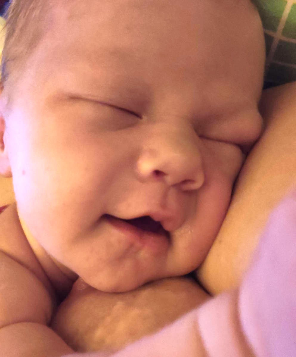 Baby auf der Mutter – Hautkontakt und Bonden